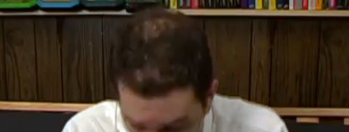 bald2